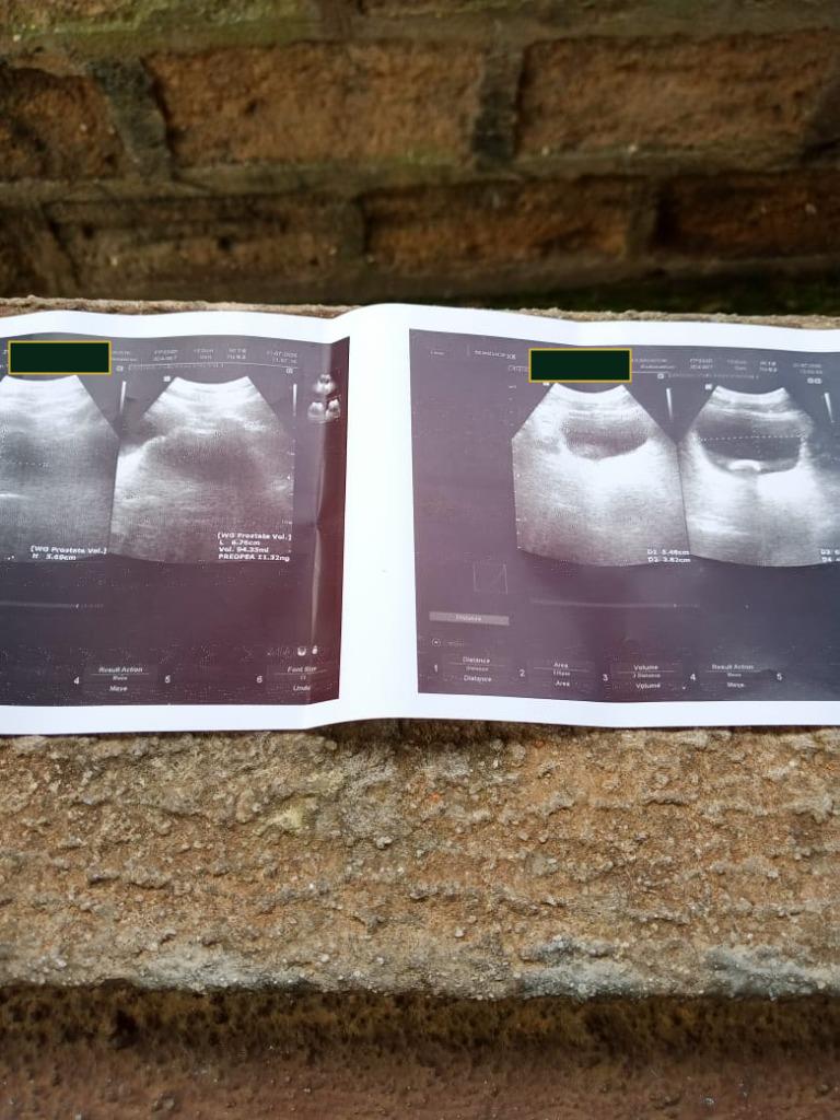 Hospital Ultrasound Thermal Sonogram Printout
